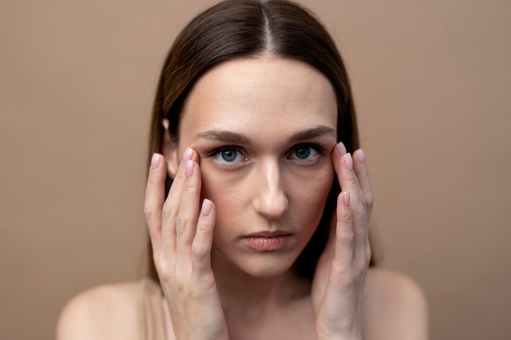7 Reasons for Dark Circles Under the Eyes and Ways to Minimize Them