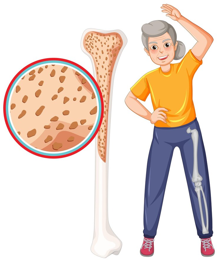Episode 96: Exploring Osteoporosis with Dr. Lisa Weeks, ND, and Elizabeth Stark