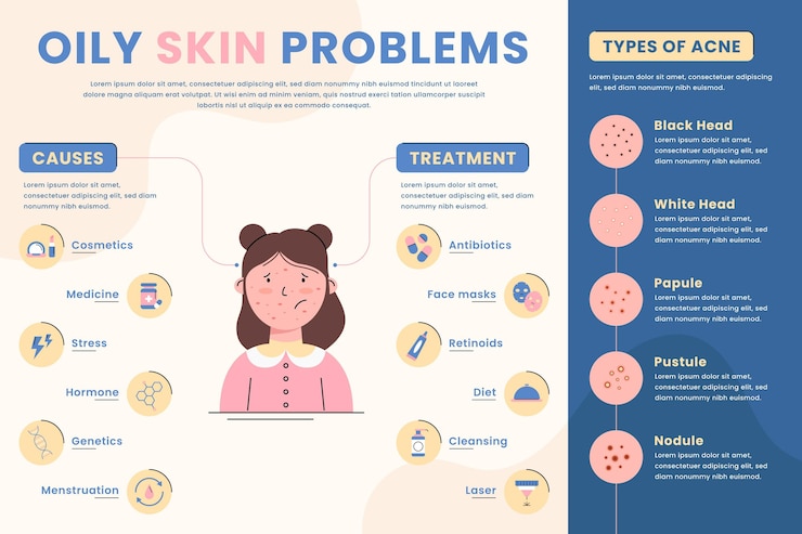 6 Nutrition and Lifestyle Tips for Acne-Prone Skin